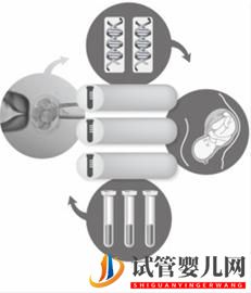 专家澄清沪首例龙虎彩票官网首页
不涉及胎儿性别(图1)