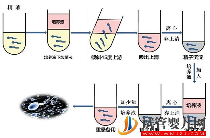 hiv患者去泰国做龙虎彩票官网首页
需要多少钱？(图2)