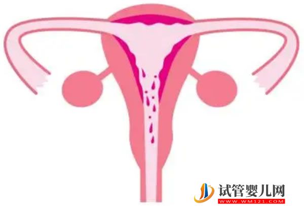 什么子宫有利于试管婴儿成功、移植前几天吃什么好？(图1)